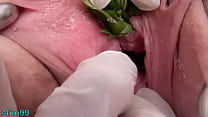 free www nettles in peehole urethral insertion nettles fisting cunt video