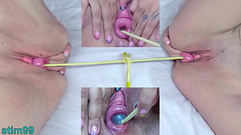 free выпадение шейки матки лесбиянки в одно и то же время video